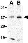 WB analysis of PC-3 cell lysate using GTX31736 Bag1 antibody. Working concentration : (A) 1 and (B) 2 microg/ml