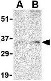 WB analysis of PC-3 cell lysate using GTX31737 Bag1 antibody. Working concentration : (A) 1 and (B) 2 microg/ml