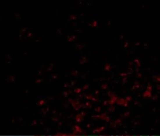 IHC-P analysis of human lymph node tissue using GTX31737 Bag1 antibody. Working concentration : 20 microg/ml