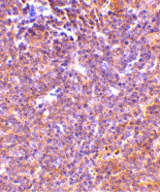 IHC-P analysis of mouse spleen tissue using GTX31742 PAK2 antibody. Working concentration : 10 microg/ml IHC-P analysis of mouse spleen tissue using GTX31742 PAK2 antibody. Working concentration : 10 microg/ml