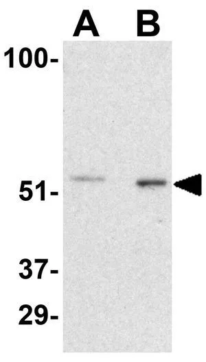 WB analysis of rat bladder tissue lysate using GTX31742 PAK2 antibody. Working concentration : (A) 0.5 and (B) 1 microg/ml