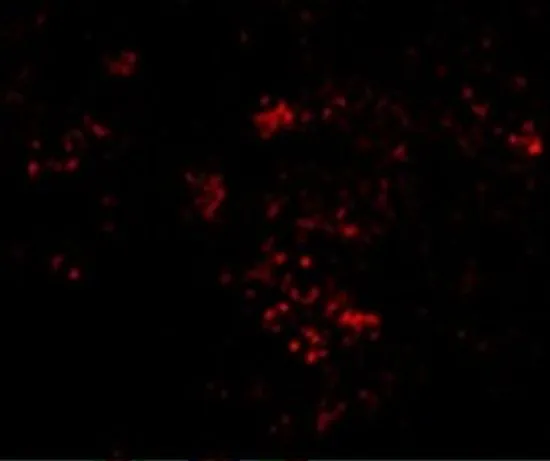 IHC-P analysis of mouse spleen tissue using GTX31742 PAK2 antibody. Working concentration : 20 microg/ml