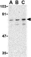 WB analysis of mouse skeletal muscle tissue lysate using GTX31744 SHP2 antibody. Working concentration : (A) 0.5,(B) 1,and (C) 2 ug/ml