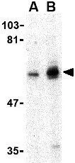 WB analysis of mouse skeletal muscle tissue lysate using GTX31745 SHP2 antibody. Working concentration : (A) 0.5 and (B) 1 ug/ml