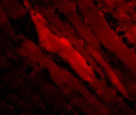 IHC-P analysis of human skeletal muscle tissue using GTX31745 SHP2 antibody. Working concentration : 20 microg/ml