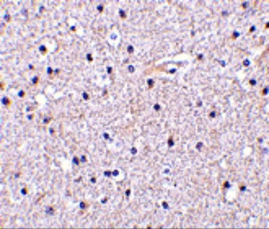 IHC-P analysis of human brain tissue using GTX31751 Nicastrin antibody. Working concentration : 5 microg/ml IHC-P analysis of human brain tissue using GTX31751 Nicastrin antibody. Working concentration : 5 microg/ml