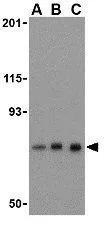 WB analysis of mouse brain tissue lysate using GTX31751 Nicastrin antibody. Working concentration : (A) 0.5, (B) 1, and (C) 2 microg/ml