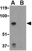 WB analysis of PC-3 cell lysate in the (A) absence or (B) presence of blocking peptide using GTX31753 LKB1 antibody. Working concentration : 1 microg/ml WB analysis of PC-3 cell lysate in the (A) absence or (B) presence of blocking peptide using GTX31753 LKB1 antibody. Working concentration : 1 microg/ml