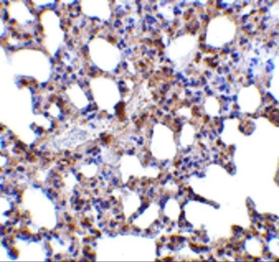 IHC-P analysis of mouse lung tissue using GTX31755 Blimp1 antibody. Working concentration : 5 ug/ml