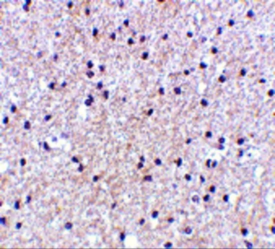 IHC-P analysis of human brain tissue using GTX31761 MORF4 antibody. Working concentration : 5 microg/ml IHC-P analysis of human brain tissue using GTX31761 MORF4 antibody. Working concentration : 5 microg/ml