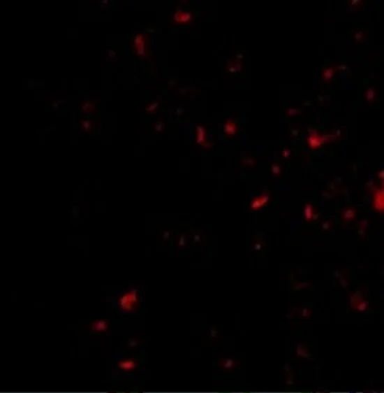 ICC/IF analysis of HepG2 cells using GTX31761 MORF4 antibody. Working concentration : 20 microg/ml