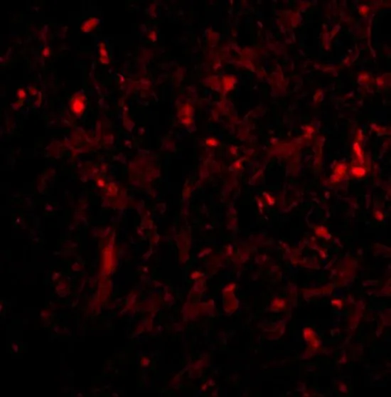 IHC-P analysis of human spleen tissue using GTX31763 RAP80 antibody. Working concentration : 20 microg/ml