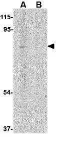 WB analysis of 293 cell lysate in (A) the absence and (B) presence of blocking peptide using GTX31763 RAP80 antibody. Working concentration : 1 microg/ml