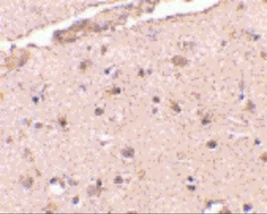 IHC-P analysis of human brain tissue using GTX31765 BRCC36 antibody. Working concentration : 2.5 microg/ml IHC-P analysis of human brain tissue using GTX31765 BRCC36 antibody. Working concentration : 2.5 microg/ml