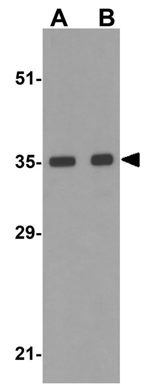 WB analysis of MCF7 cell lysate using GTX31765 BRCC36 antibody. Working concentration : (A) 0.5 and (B) 1 microg/ml
