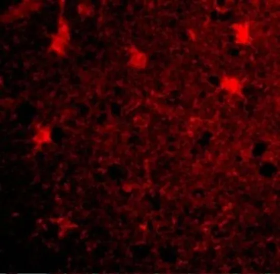 IHC-P analysis of human brain tissue using GTX31765 BRCC36 antibody. Working concentration : 20 microg/ml