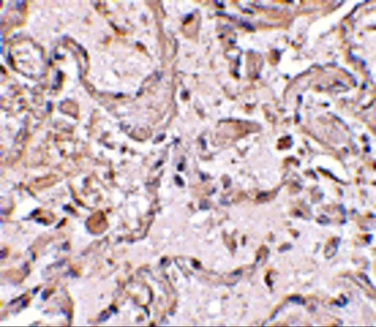 IHC-P analysis of human lung tissue using GTX31766 GSTP1 antibody. Working concentration : 2.5 microg/ml IHC-P analysis of human lung tissue using GTX31766 GSTP1 antibody. Working concentration : 2.5 microg/ml