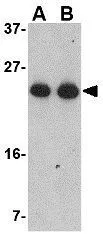 WB analysis of Jurkat cell lysate using GTX31766 GSTP1 antibody. Working concentration : (A) 0.5 and (B) 1 microg/ml