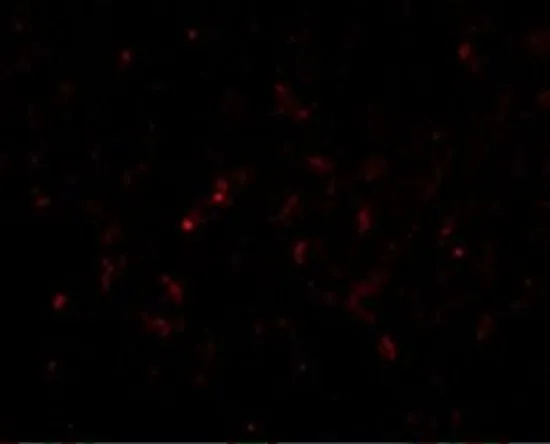 IHC-P analysis of human lung tissue using GTX31766 GSTP1 antibody. Working concentration : 20 microg/ml
