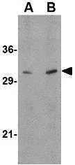 WB analysis of human brain tissue lysate using GTX31768 ATG12 antibody. Working concentration : (A) 0.5 and (B) 1 microg/ml