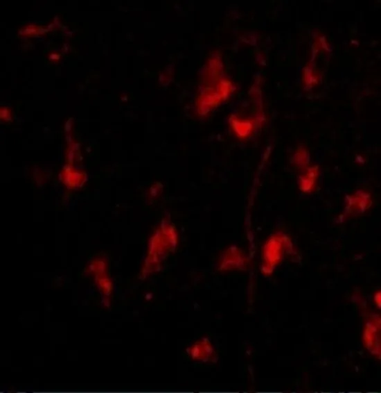 IHC-P analysis of human brain tissue using GTX31768 ATG12 antibody. Working concentration : 20 microg/ml