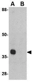 WB analysis of mouse heart tissue lysate in (A) the absence and (B) the presence of blocking peptide using GTX31769 ATG12 antibody. Working concentration : 1 microg/ml