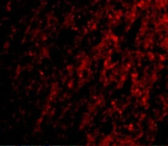 IHC-P analysis of human brain tissue using GTX31769 ATG12 antibody. Working concentration : 20 microg/ml