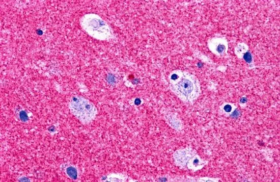 IHC-P analysis of human brain tissue using GTX31772 RIM2 antibody. Working concentration : 5 microg/ml IHC-P analysis of human brain tissue using GTX31772 RIM2 antibody. Working concentration : 5 microg/ml