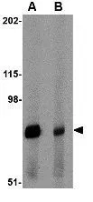 WB analysis of rat spleen tissue lysate in (A) the absence and (B) the presence of blocking peptide using GTX31781 Integrin alpha 4 antibody. Working concentration : 1 microg/ml WB analysis of rat spleen tissue lysate in (A) the absence and (B) the presence of blocking peptide using GTX31781 Integrin alpha 4 antibody. Working concentration : 1 microg/ml