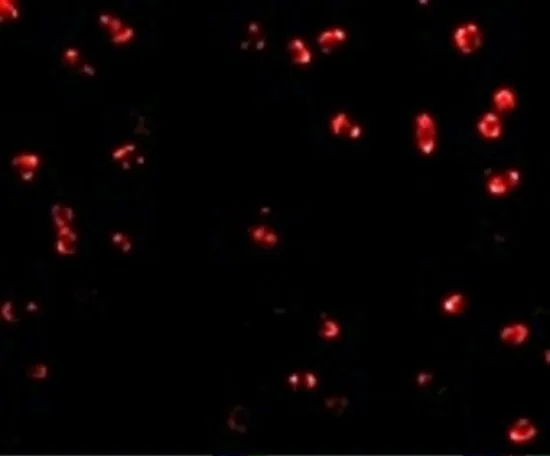 ICC/IF analysis of Jurkat cells using GTX31781 Integrin alpha 4 antibody. Working concentration : 2 microg/ml