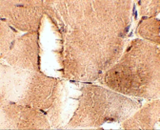 IHC-P analysis of mouse skeletal muscle tissue using GTX31783 JPH1 antibody. Working concentration : 2.5 microg/ml IHC-P analysis of mouse skeletal muscle tissue using GTX31783 JPH1 antibody. Working concentration : 2.5 microg/ml