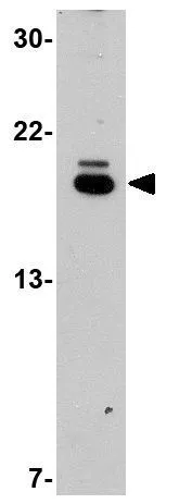 WB analysis of EL4 cell lysate using GTX31784 STK39 antibody. Working concentration : 1microg/ml WB analysis of EL4 cell lysate using GTX31784 STK39 antibody. Working concentration : 1microg/ml