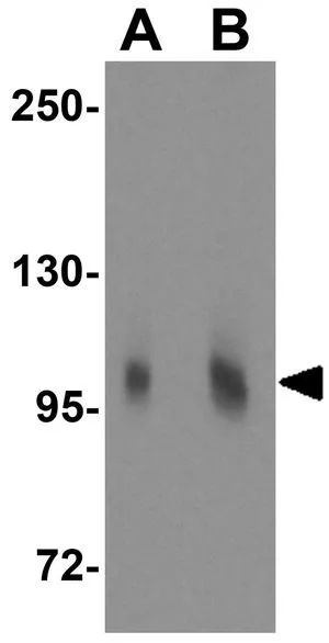 WB analysis of 3T3 cell lysate using GTX31788 Matrilin 2 antibody. Working concentration : (A) 1 and (B) 2 microg/ml WB analysis of 3T3 cell lysate using GTX31788 Matrilin 2 antibody. Working concentration : (A) 1 and (B) 2 microg/ml