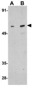 WB analysis of Raji cell lysate using GTX31789 RUNX1 antibody. Working concentration : (A) 1 and (B) 2 microg/ml WB analysis of Raji cell lysate using GTX31789 RUNX1 antibody. Working concentration : (A) 1 and (B) 2 microg/ml
