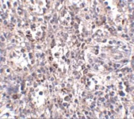 IHC-P analysis of human spleen tissue using GTX31791 SR-BI antibody. Working concentration : 2.5 microg/ml