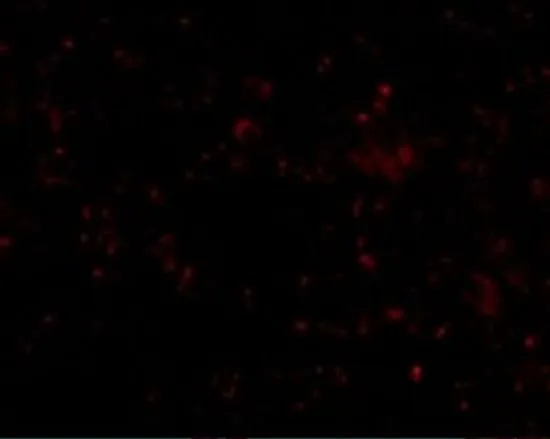 IHC-P analysis of human spleen tissue using GTX31791 SR-BI antibody. Working concentration : 20 microg/ml