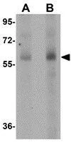 WB analysis of human spleen tissue lysate using GTX31791 SR-BI antibody. Working concentration : (A) 1 and (B) 2 microg/ml