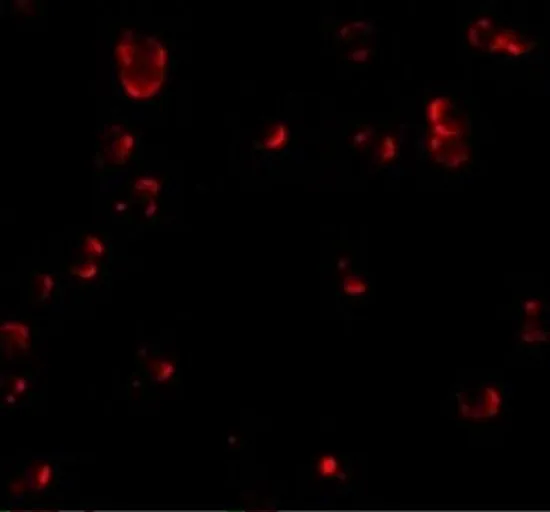 ICC/IF analysis of HeLa cells using GTX31792 EFEMP1 antibody. Working concentration : 20 microg/ml