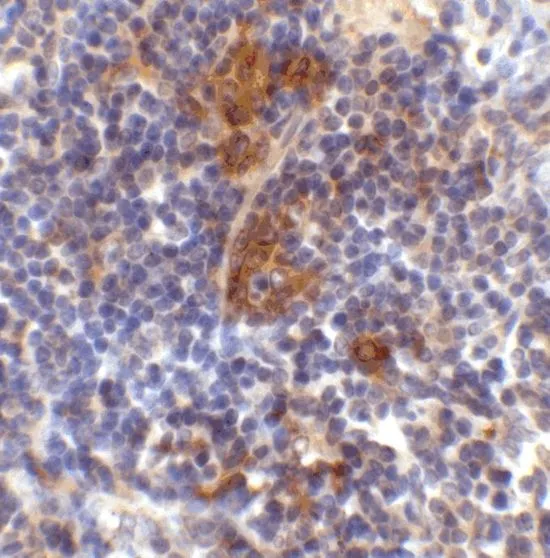 IHC-P analysis of mouse spleen tissue using GTX31795 SQSTM1 antibody. Working concentration : 2 microg/ml