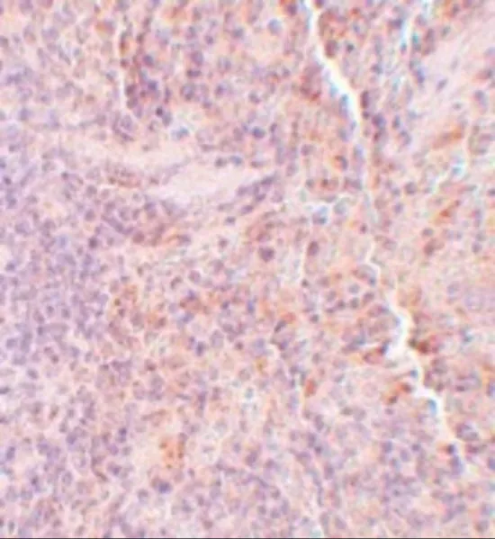 IHC-P analysis of rat spleen tissue using GTX31795 SQSTM1 antibody. Working concentration : 5 microg/ml