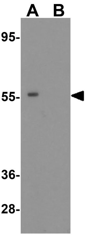 WB analysis of K562 cell lysate in (A) the absence and (B) the presence of blocking peptide using GTX31795 SQSTM1 antibody. Working concentration : 1 microg/ml