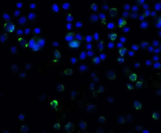 ICC/IF analysis of A431 cells using GTX31795 SQSTM1 antibody. Working concentration : 20 microg/ml