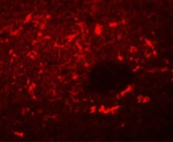 IHC-P analysis of rat spleen tissue using GTX31795 SQSTM1 antibody. Working concentration : 20 microg/ml