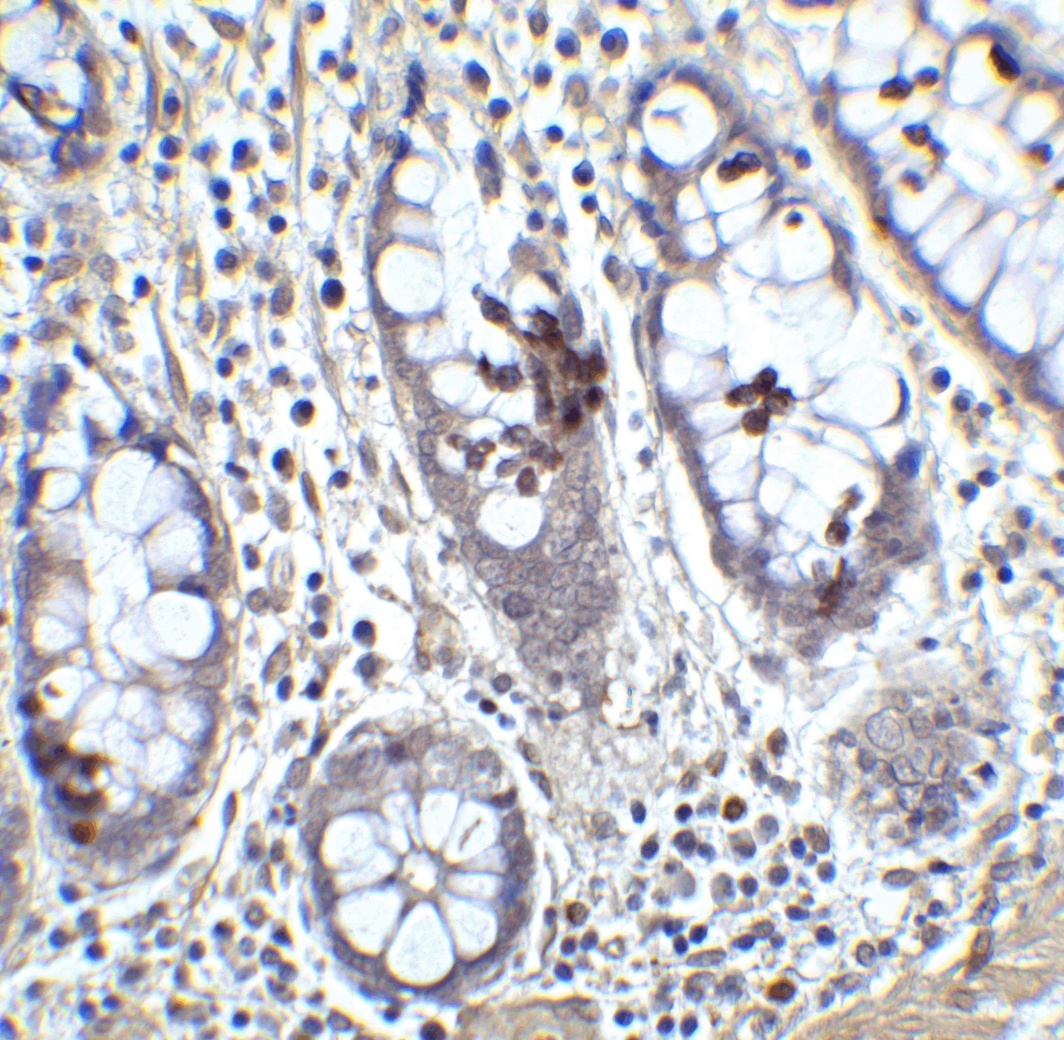 IHC-P analysis of human colon tissue using GTX31798 KLF4 antibody. Dilution : 5 microg/ml