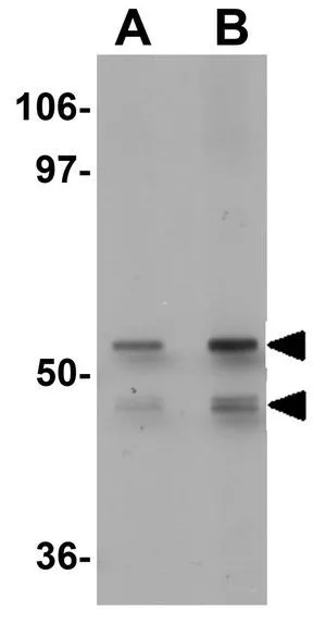 WB analysis of human liver tissue lysate using GTX31798 KLF4 antibody. Working concentration : (A) 1 and (B) 2 microg/ml
