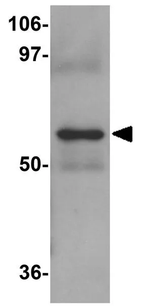 WB analysis of human lung tissue lysate using GTX31800 NABC1 antibody. Working concentration : 1 microg/ml