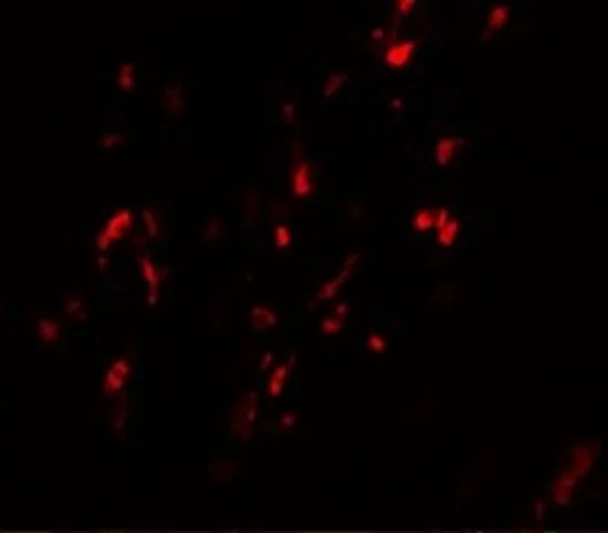 IHC-P analysis of human breast carcinoma tissue using GTX31800 NABC1 antibody. Working concentration : 20 microg/ml