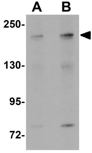 WB analysis of SK-N-SH cell lysate using GTX31801 APC1 antibody. Working concentration : (A) 1 and (B) 2 microg/ml