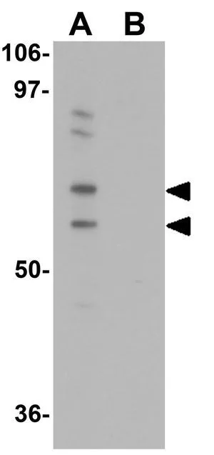 WB analysis of 293 cell lysate in (A) the absence and (B) the presence of blocking peptide using GTX31804 UBA2 antibody. Working concentration : 0.25 microg/ml WB analysis of 293 cell lysate in (A) the absence and (B) the presence of blocking peptide using GTX31804 UBA2 antibody. Working concentration : 0.25 microg/ml