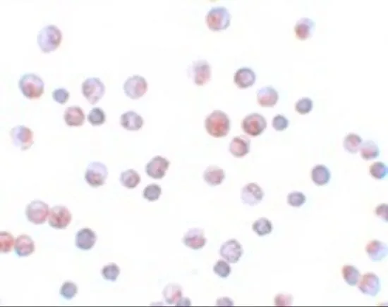 ICC/IF analysis of HeLa cells using GTX31806 FOXO1 antibody. Working concentration : 4 microg/ml